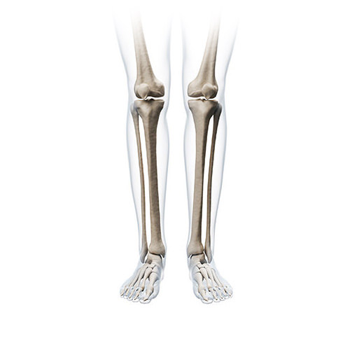 Canadian Limb Lengthening Center | Ankle and hindfoot fusion (arthrodesis)